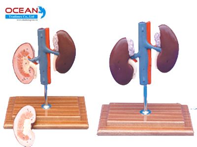 Mô hình thận lợn